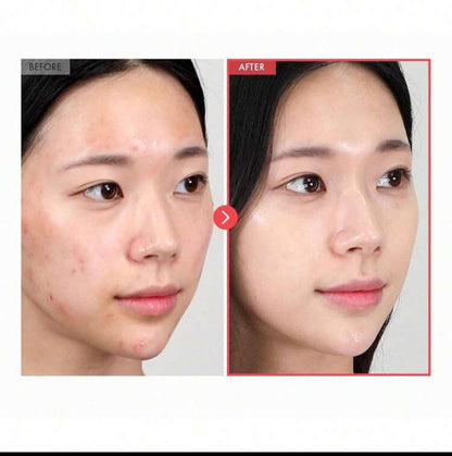 Peel Shot Glow Serum