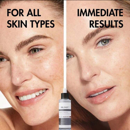 Peel Shot Glow Serum